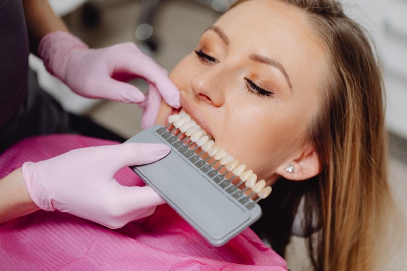 Guía de tonos dentales comparada junto a la sonrisa de una paciente